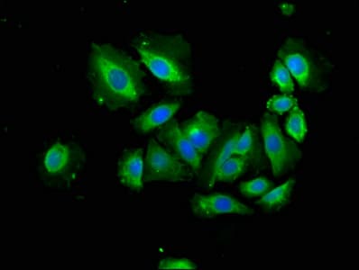 Polyclonal Rabbit anti-Human APAF1 / APAF-1 Antibody (IHC)