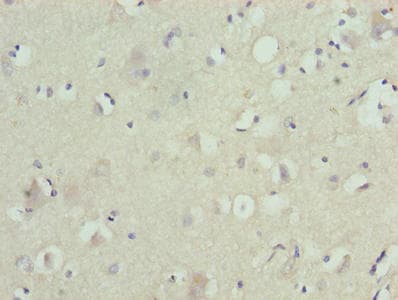 Polyclonal Rabbit anti-Human ZNF821 Antibody (IHC, WB)