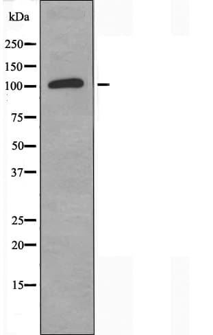 Polyclonal Rabbit anti-Human CNTN6 / Contactin 6 Antibody (IF, WB)