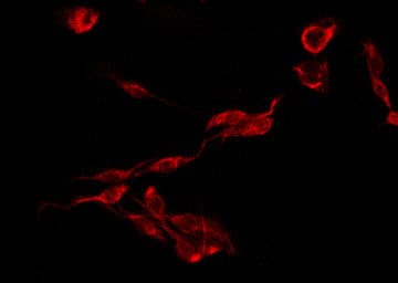 Polyclonal Rabbit anti-Human CMTM3 Antibody (IF, WB)
