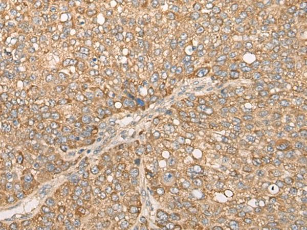 CAPN15 / SOLH Antibody