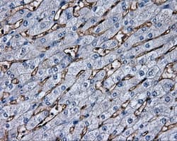 AKR1A1 Antibody (clone OTI4G6)