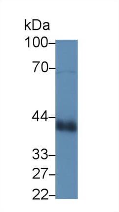 CLU / Clusterin Antibody (aa223-439)