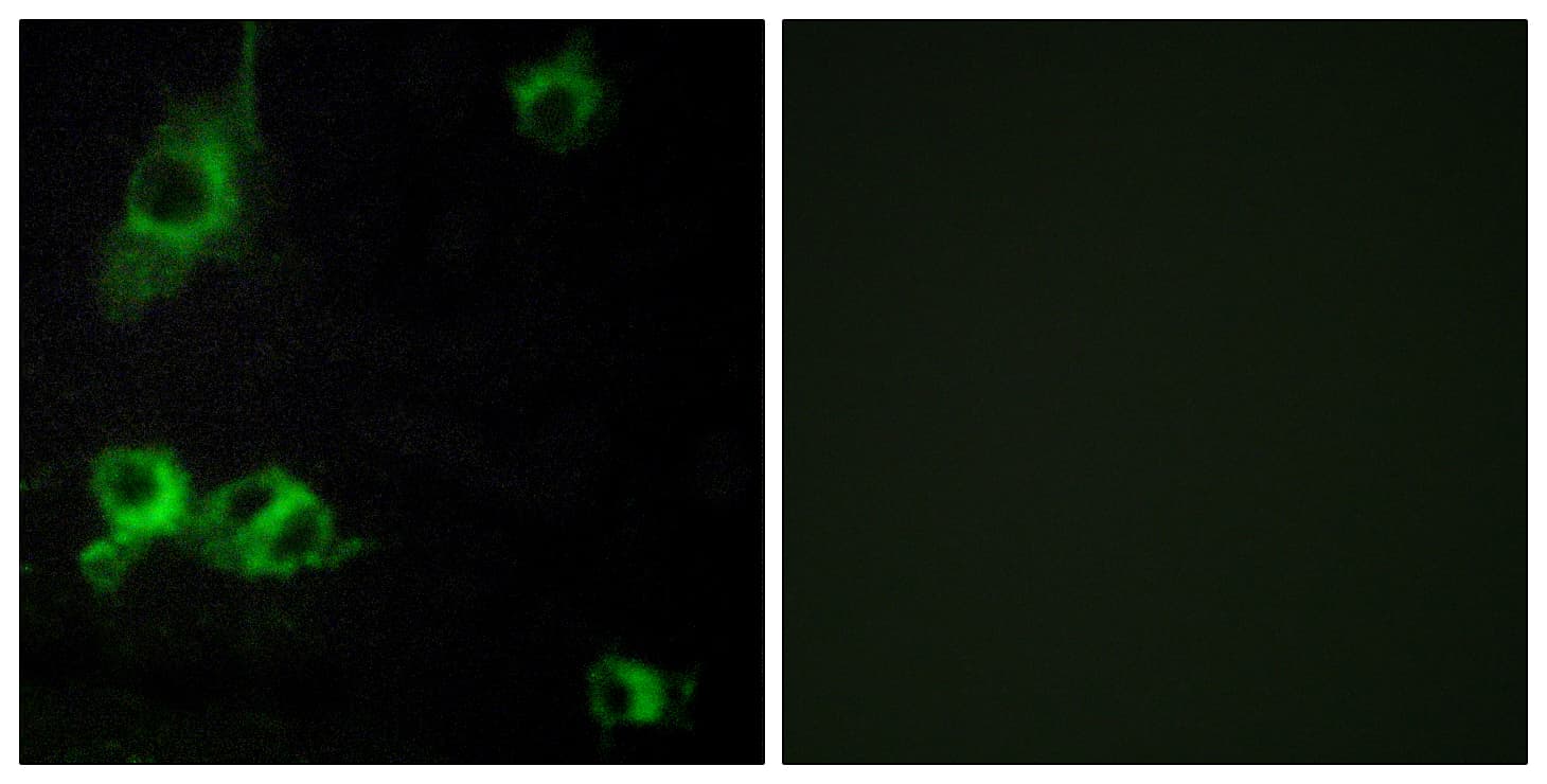 LAMA1 / Laminin Alpha 1 Antibody (aa2501-2550)