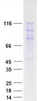 Human CTNND1 / p120 Catenin Protein (Recombinant Myc-DDK (Flag))