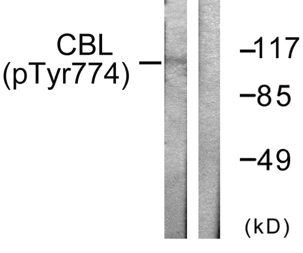c-CBL Antibody (phospho-Tyr774)