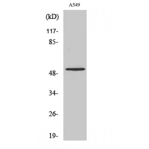 Polyclonal Rabbit anti-Human MMP17 Antibody (80-160 aa, Internal, WB)