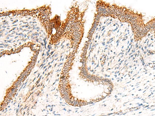 GRIK5 / KA2 Antibody