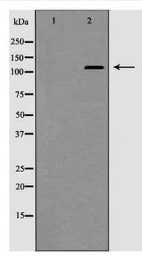 HDAC5 Antibody