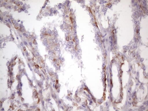 Monoclonal Mouse anti-Human CSF2 / GM-CSF Antibody (clone OTI1A3, aa18-144, IHC, WB)