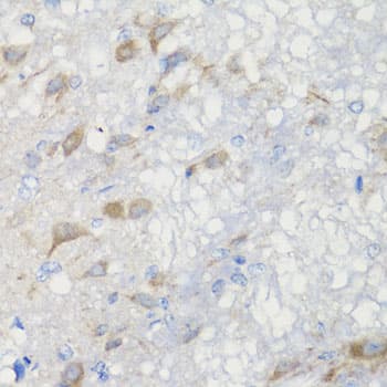 CHIC2 Antibody