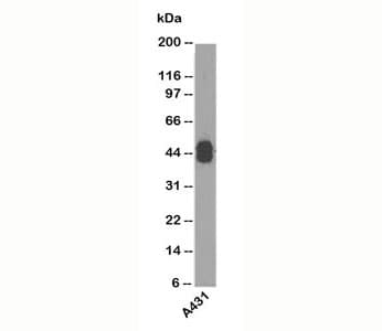 Acidic Cytokeratin AE1 Antibody (clone AE1, Ready-to-Use)