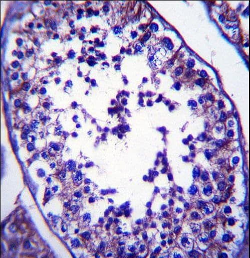 Polyclonal Rabbit anti-Human SLC27A3 Antibody (aa124-152, IHC, WB)