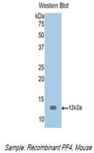 CXCL4 / PF4 Antibody (aa30-105, Cy3)