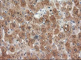 HDHD2 Antibody (clone OTI5C5)