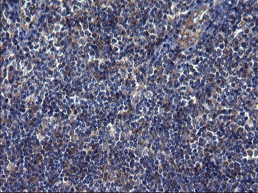 TUBA1A / Tubulin Alpha 1a Antibody (clone OTI2C8)