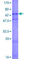 Human WISP3 Protein (Recombinant GST)