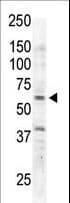 RYK Antibody (aa160-190)
