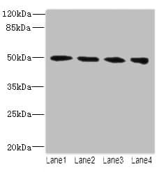 TUBB2A / Tubulin Beta 2A Antibody (aa1-445)