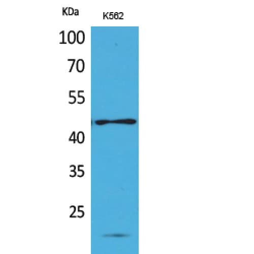 RHAG Antibody (1-50 aa, N-terminal)
