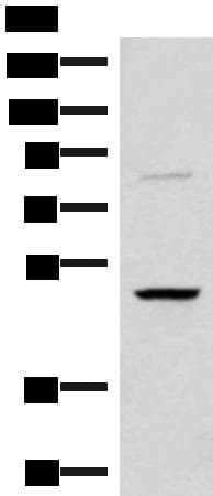Polyclonal Rabbit anti-Human RRP8 Antibody (WB)