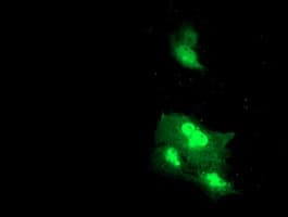 DTNB / Dystrobrevin Beta Antibody (clone OTI3A12)
