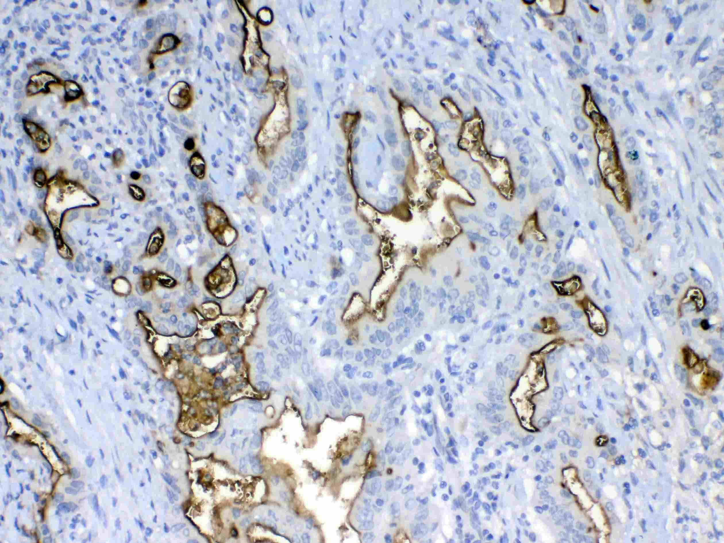 Polyclonal Rabbit anti-Human EMA / MUC1 Antibody (IHC, WB)