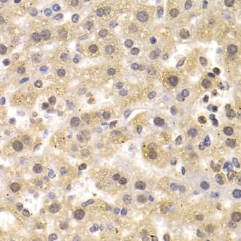 NUDT6 Antibody
