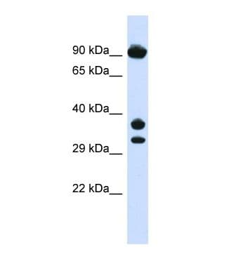 Polyclonal Rabbit anti-Human CYB561 Antibody (aa99-148, WB)