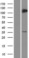 TRIM5 Protein (Over-Expression Lysate Myc-DDK (Flag))