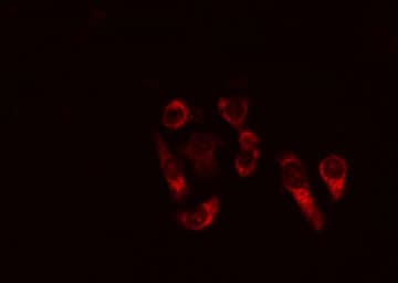BCL2L1 / BCL-XL Antibody