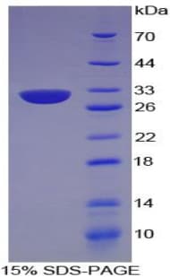 Human CENPI / CENP-I Protein (Recombinant His-T7)