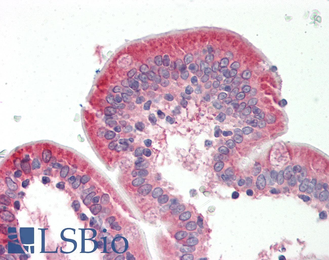 NET1 / ARHGEF8 Antibody (aa288-337)