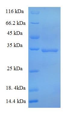 Human SKP1 Protein (Recombinant GST)