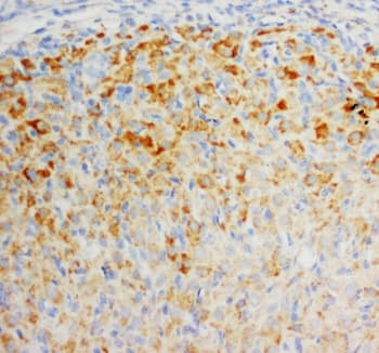 FGF8 Antibody (aa192-214)