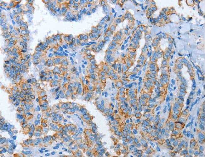 ASL / Argininosuccinate Lyase Antibody