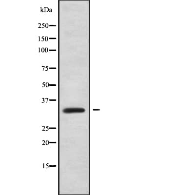Polyclonal Rabbit anti-Human PPP1R3D Antibody (IF, WB)
