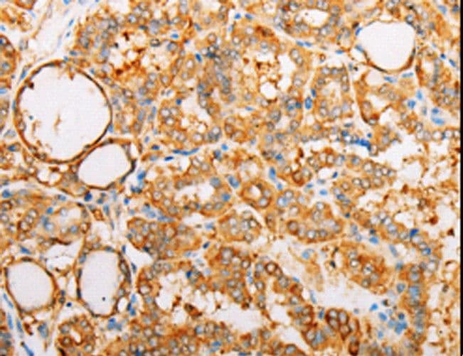 ARF1 Antibody