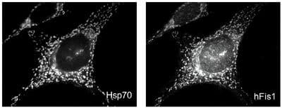 Polyclonal Rabbit anti-Human FIS1 Antibody (WB)
