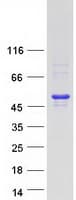 Human MEIS3 Protein (Recombinant Myc-DDK (Flag))