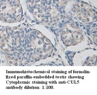 CUL5 / Cullin-5 Antibody (C-Terminus)