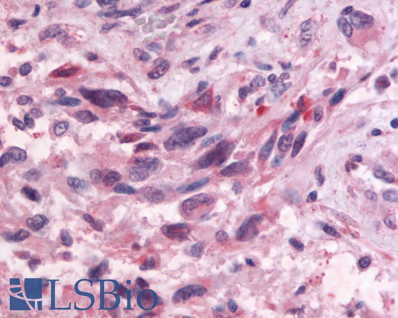 PathPlus™ Polyclonal Rabbit anti-Human GPR83 Antibody (Cytoplasmic Domain, IHC)