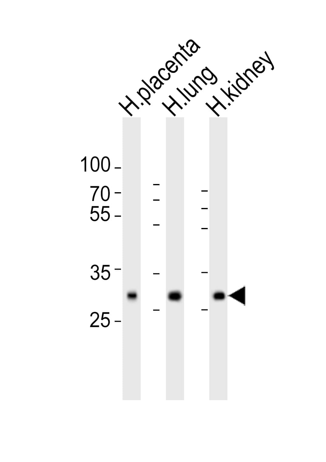 SOD3 Antibody (aa186-219)
