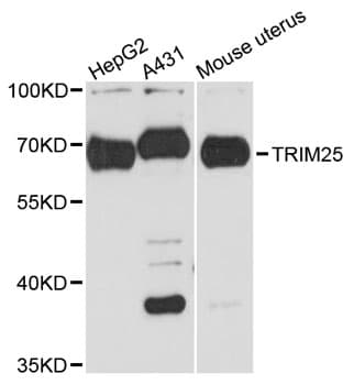 TRIM25 Antibody