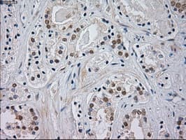 MAPK8 / JNK1 Antibody (clone OTI2C6)