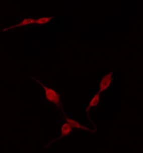 TNFAIP8L2 Antibody