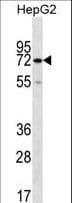 Polyclonal Rabbit anti-Human CTP Synthetase 2 / CTPS2 Antibody (aa450-479, WB)