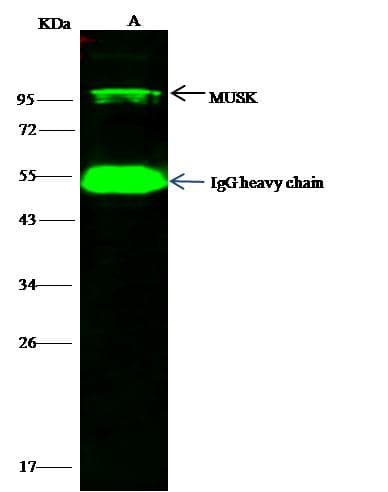 MUSK Antibody (Preservative Free)