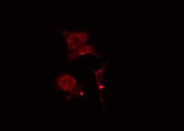 Polyclonal Rabbit anti-Human HURP / DLGAP5 Antibody (IHC, IF, WB)