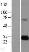 Human CELA3A / ELA3 Protein (Over-Expression Lysate Myc-DDK (Flag))